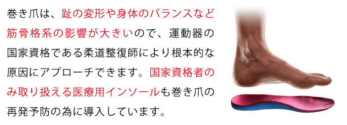 巻き爪は、趾の変形や身体のバランスなど筋骨格系の影響が大きいので、運動器の国家資格である柔道整復師により根本的な原因にアプローチできます。国家資格者のみ取り扱える医療用インソールも巻き爪の再発予防の為に導入しています。